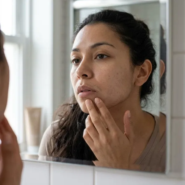 How long do facial laser results last?