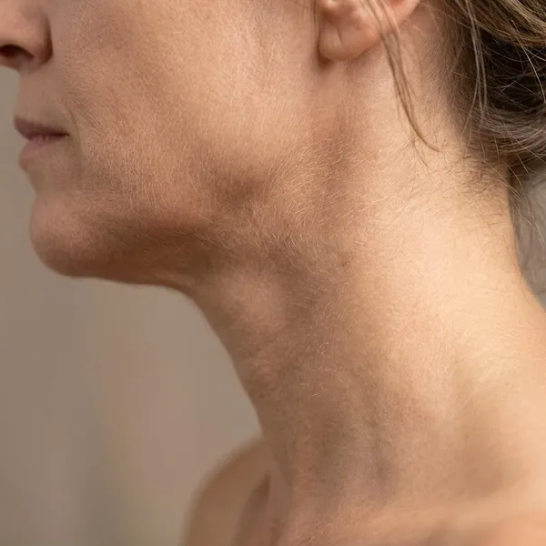 Why does neck peach fuzz get longer or more noticeable?